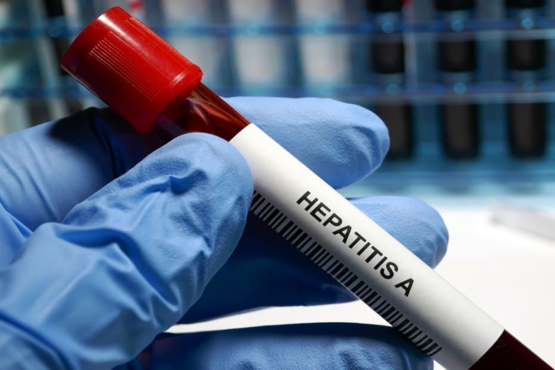 A típusú hepatitisfertőzés Nagykaposon