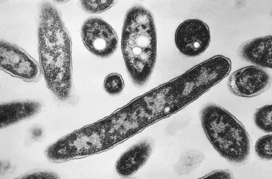 Legionella-baktériumra figyelmeztet a fővárosi vízművek